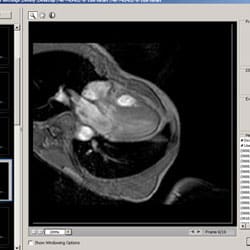 Medical Imaging with DICOM files